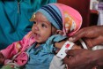 Natsaannat, a health extension worker in Wara Village, Ethiopia, counsels Aynamam on how to treat malnutrition in her child, Bitu.