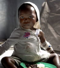 Pictured is a young child suffering from cholera and receiving food aid from the Agency. Photographer: © Frederic Courbet /Panos